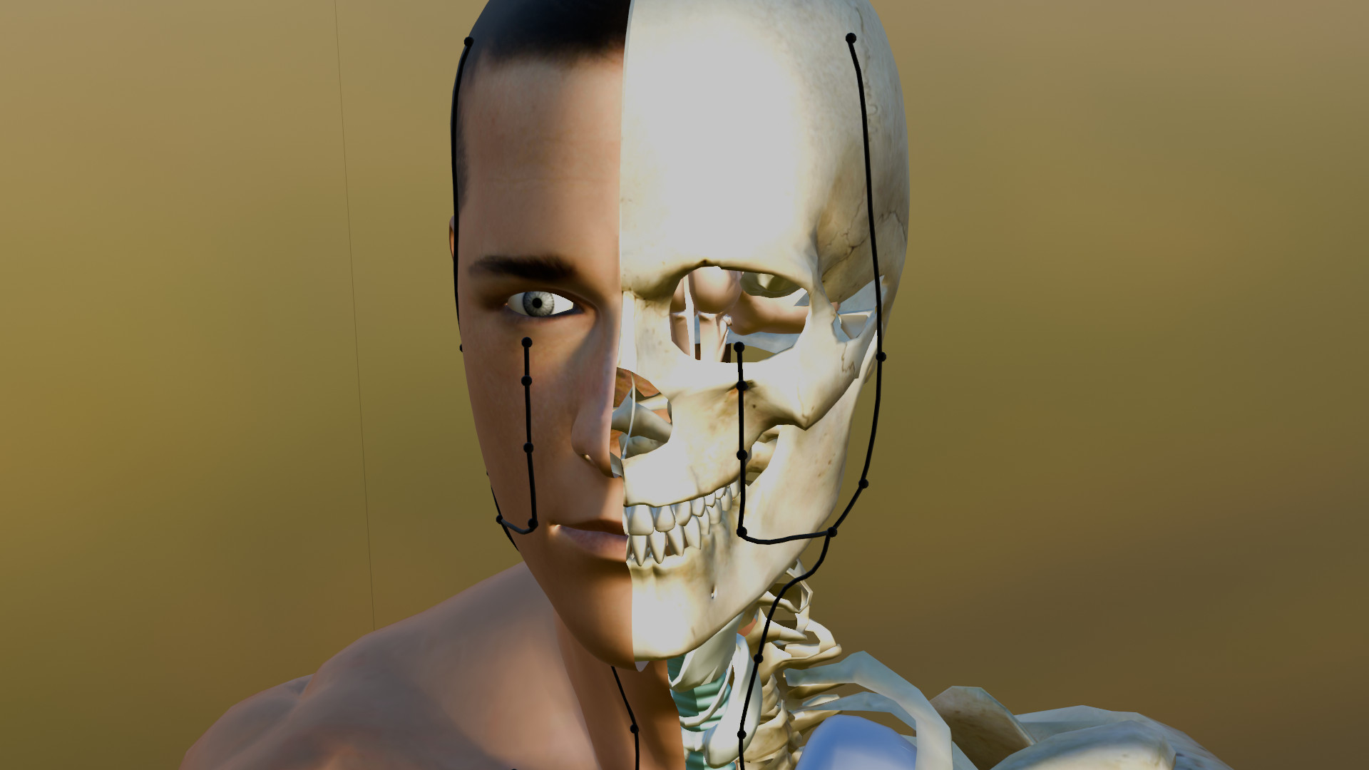 ST-5 and ST-6 — 3D headshot with bone overlay